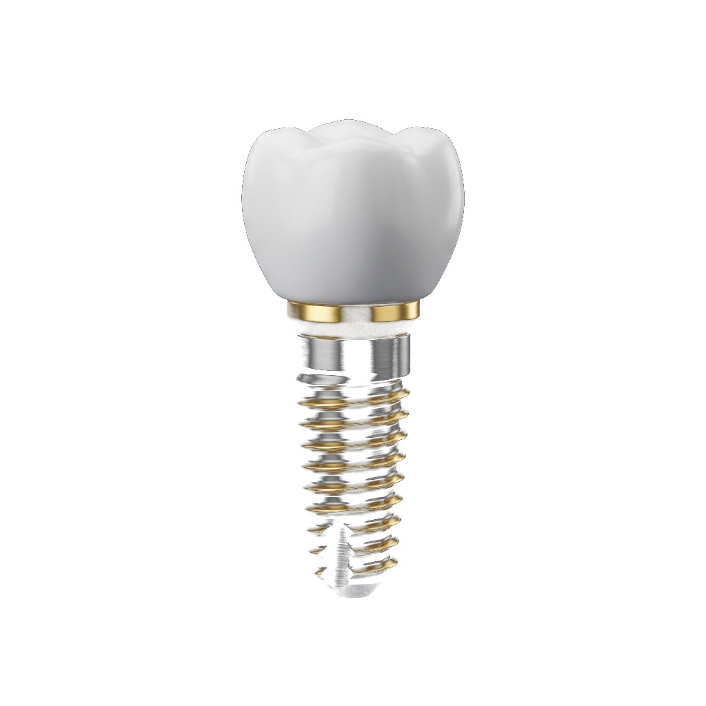 Implantes e Reabilitação